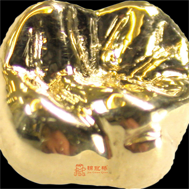 Gold porcelain teeth