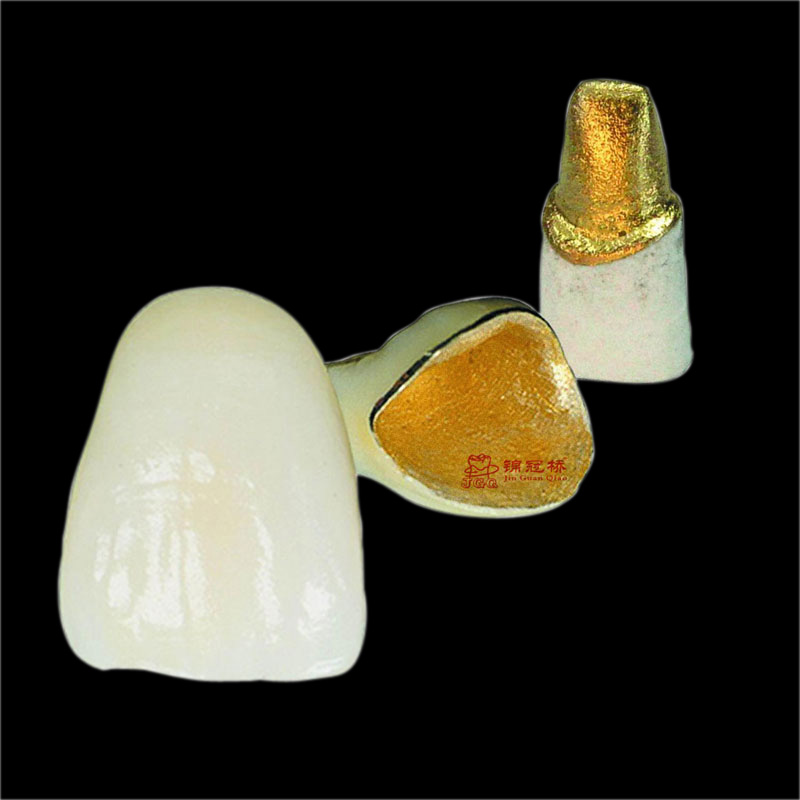 Gold deposition porcelain teeth